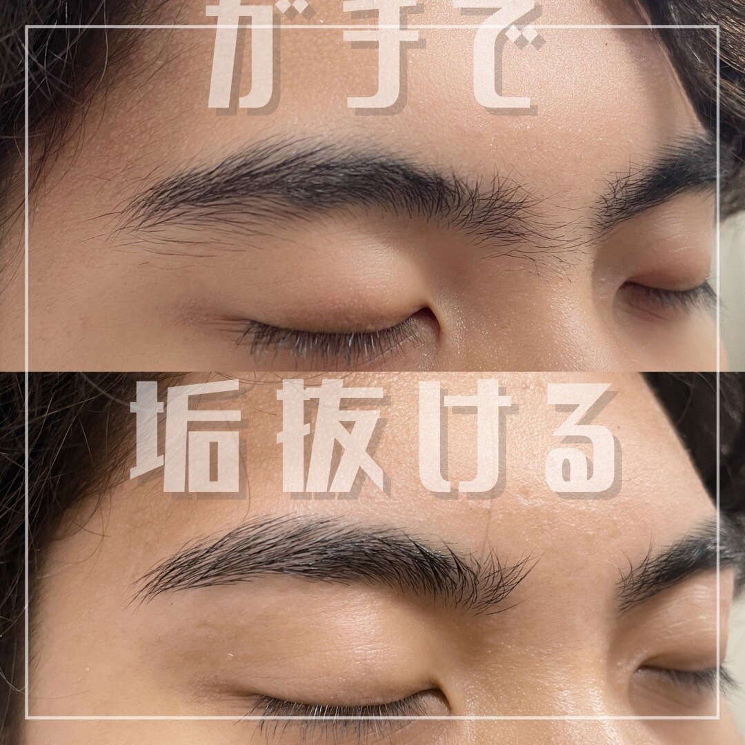 施術例③