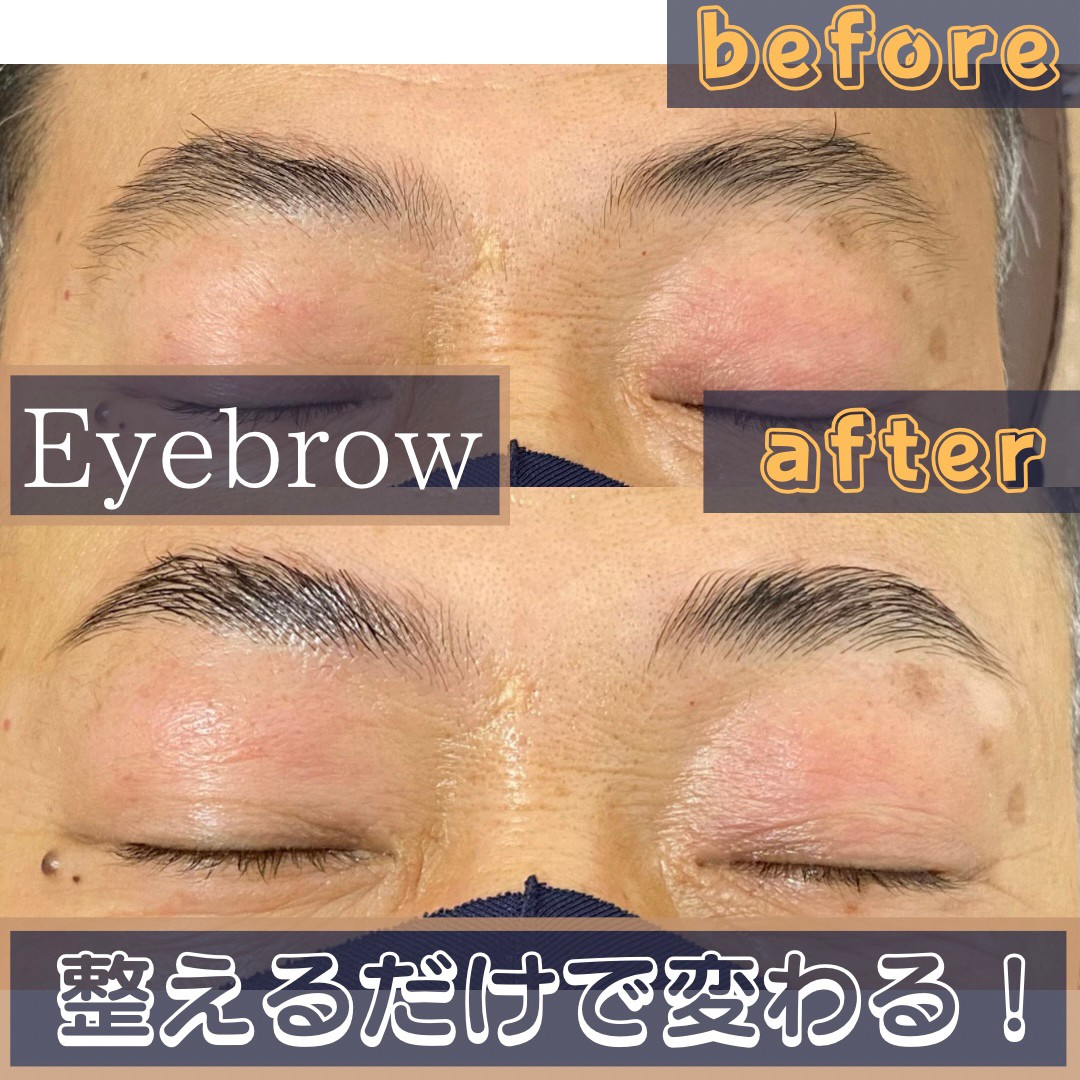 施術例④